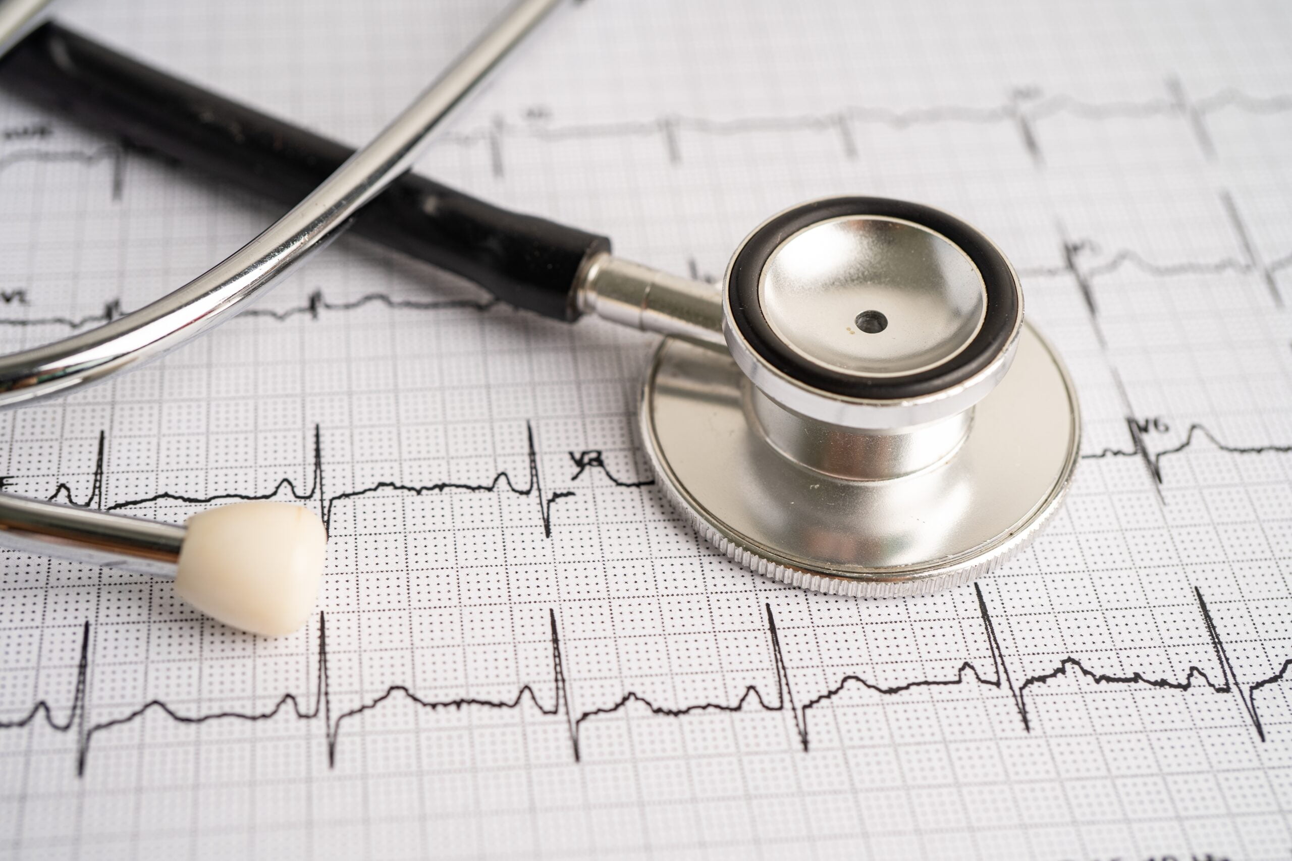 What are heart arrhythmias? - The Common Good